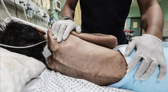 Barbar İsrail kıtlığı dayattığı Gazze’de son 24 saatte 5 kişiyi daha aç bırakarak öldürdü!